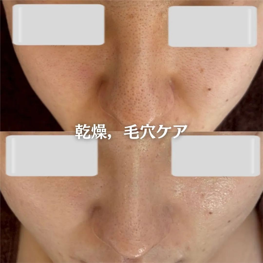 @beautysalonfacile 👈🏻他投稿もチェック