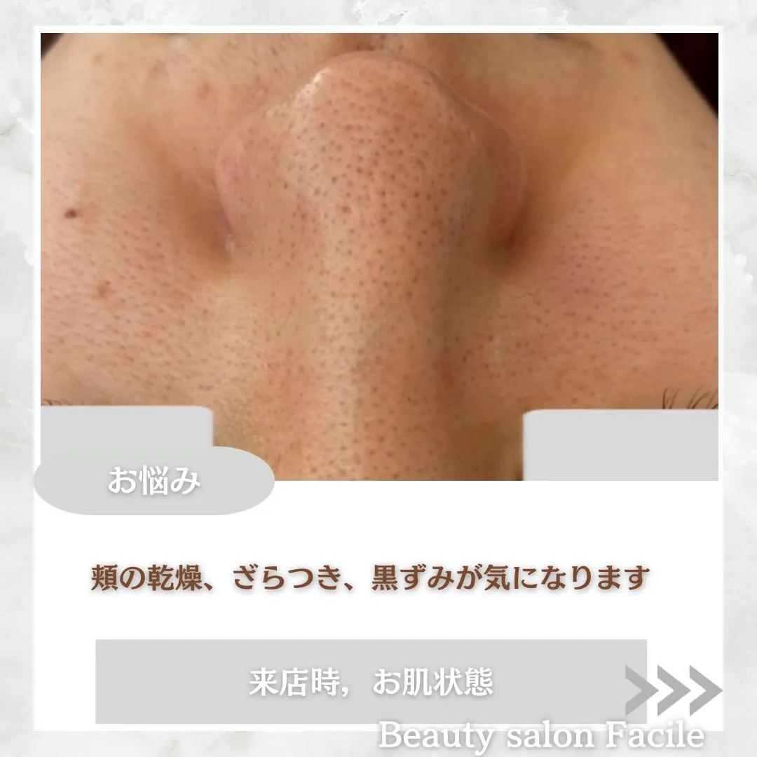 @beautysalonfacile 👈🏻他投稿もチェック
