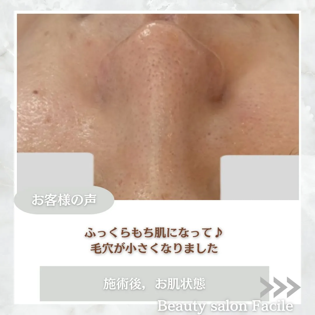 @beautysalonfacile 👈🏻他投稿もチェック