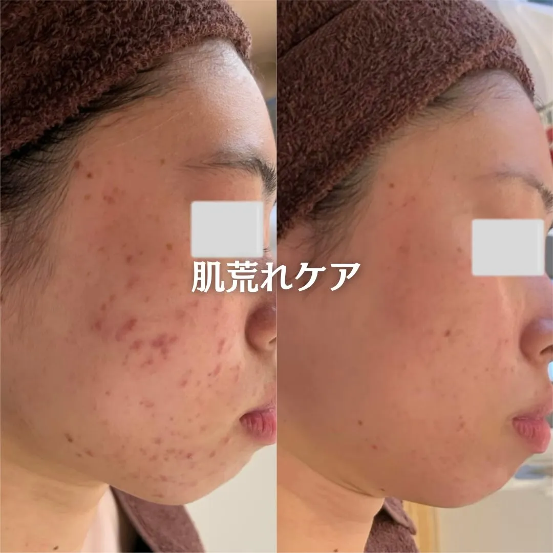 @beautysalonfacile 👈🏻他投稿もチェック