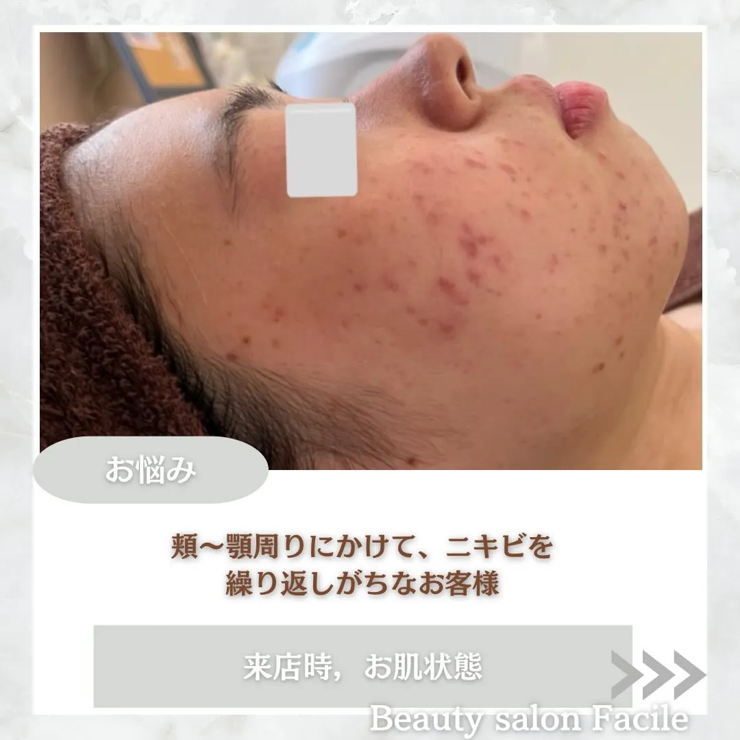 @beautysalonfacile 👈🏻他投稿もチェック