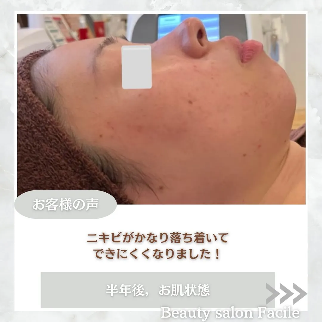 @beautysalonfacile 👈🏻他投稿もチェック