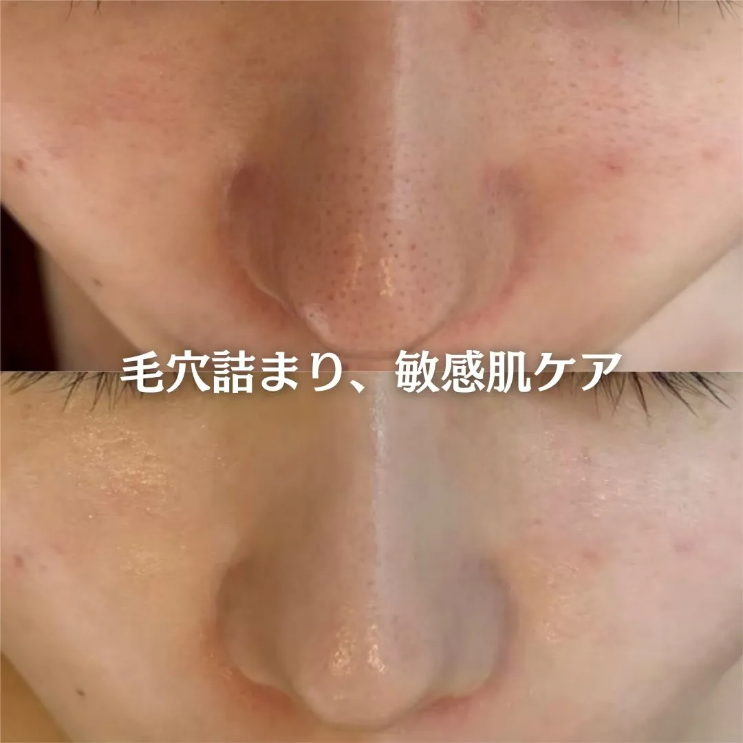 @beautysalonfacile 👈🏻他投稿もチェック