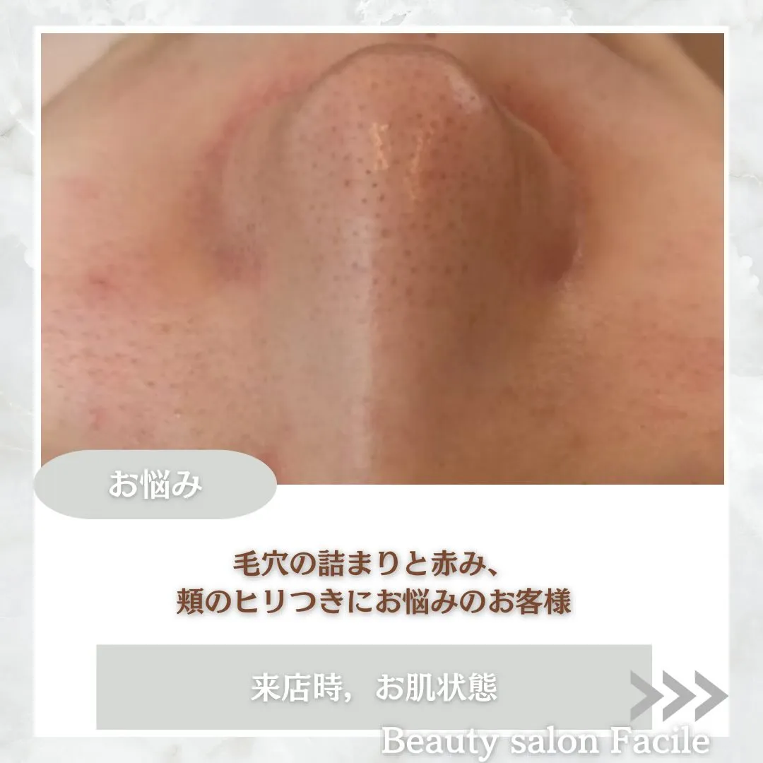 @beautysalonfacile 👈🏻他投稿もチェック