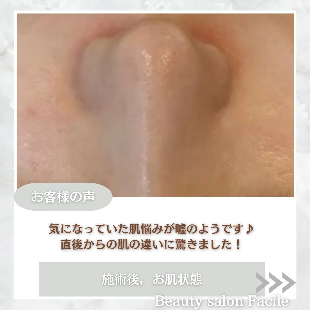 @beautysalonfacile 👈🏻他投稿もチェック