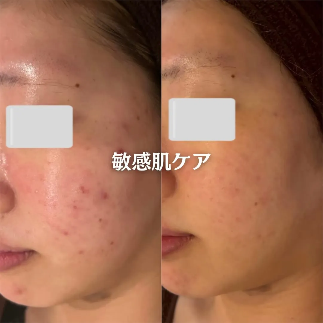 @beautysalonfacile 👈🏻他投稿もチェック
