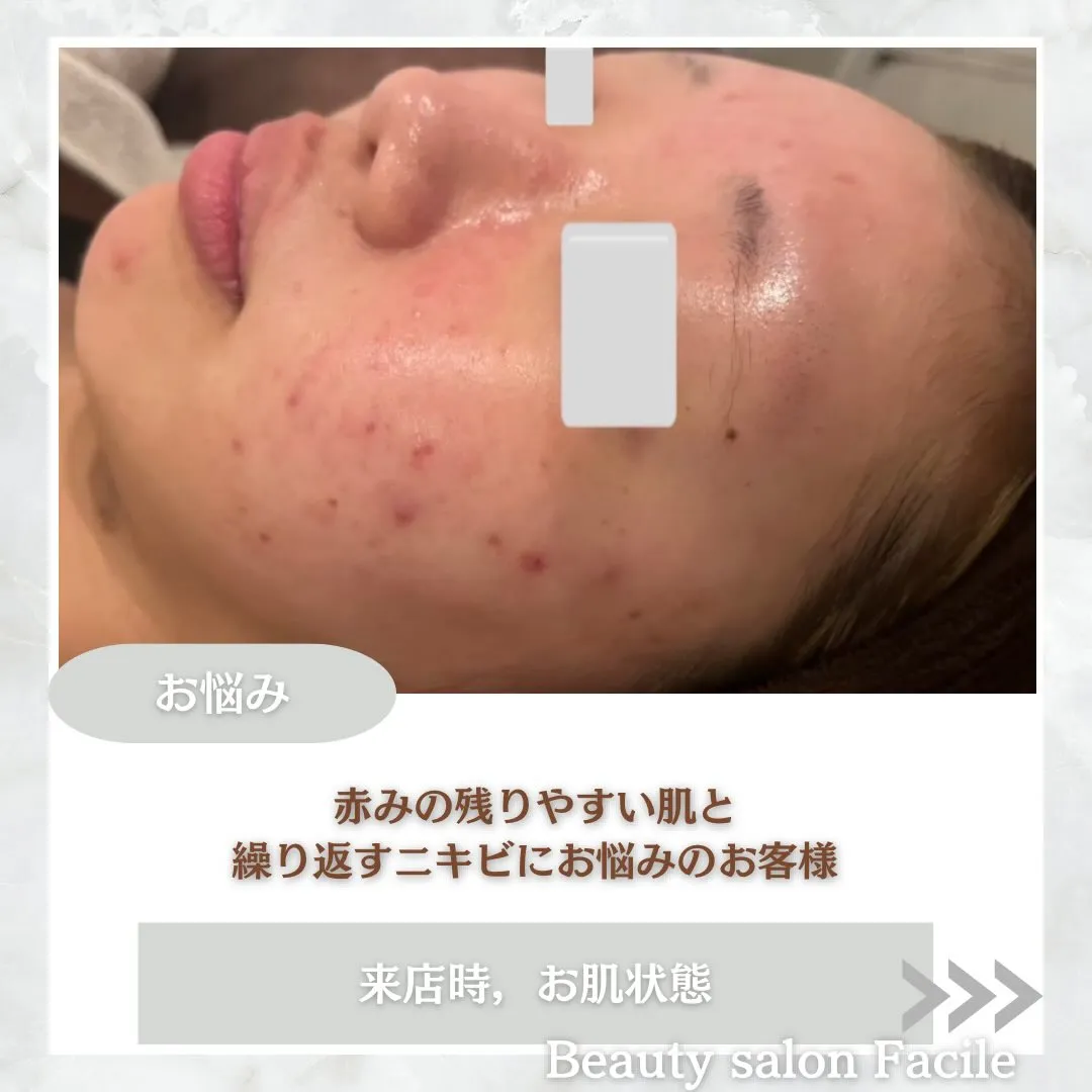 @beautysalonfacile 👈🏻他投稿もチェック