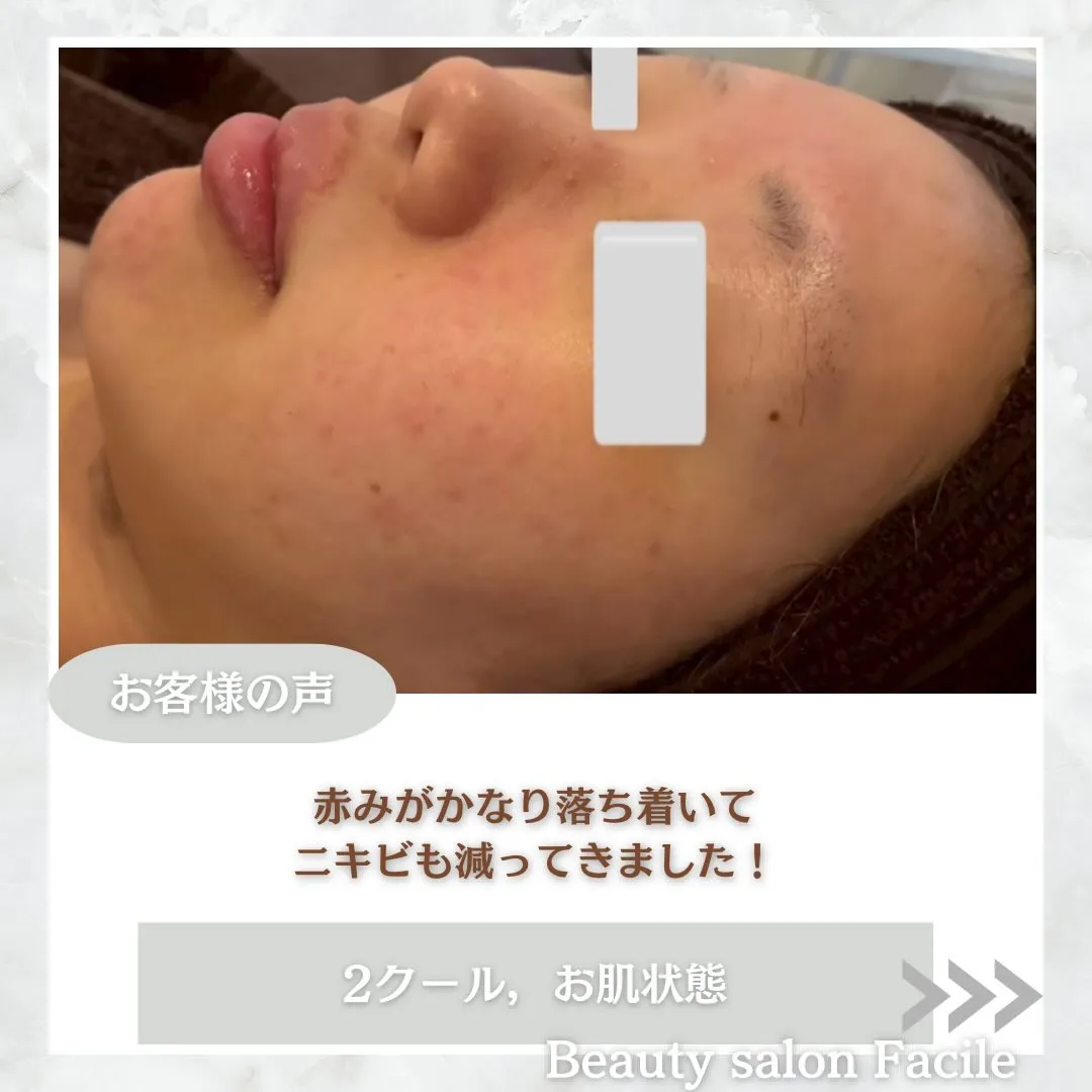 @beautysalonfacile 👈🏻他投稿もチェック