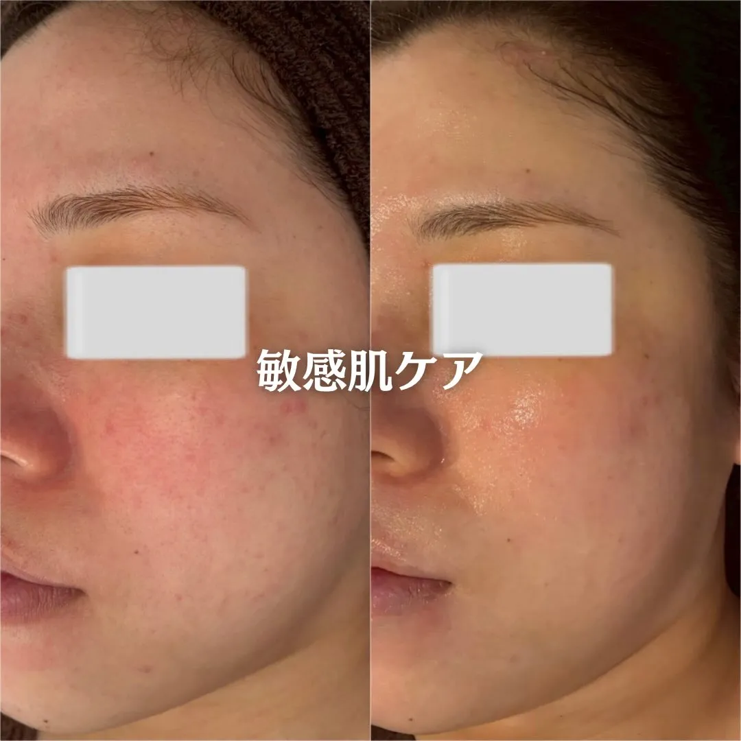 @beautysalonfacile 👈🏻他投稿もチェック