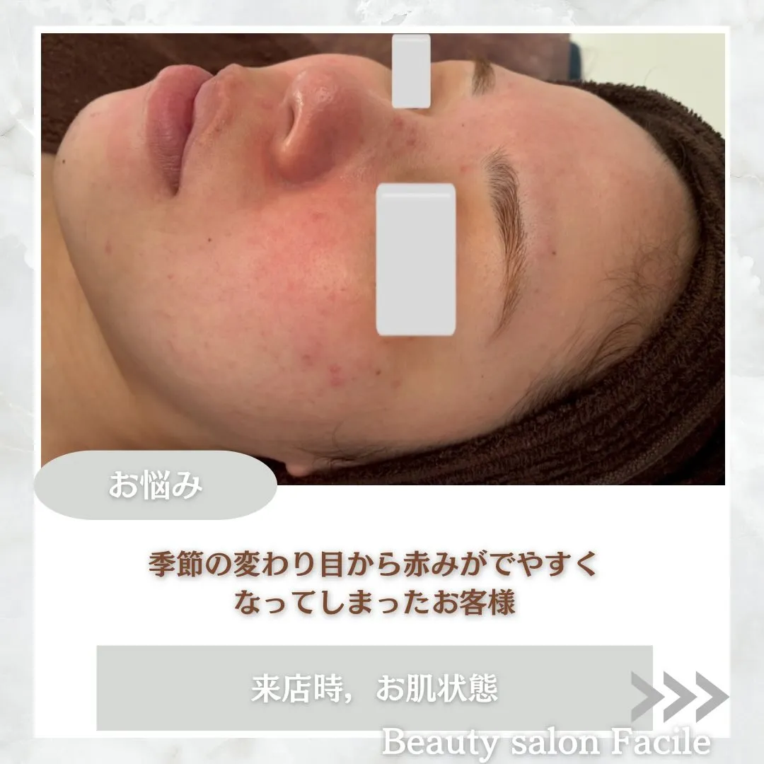 @beautysalonfacile 👈🏻他投稿もチェック