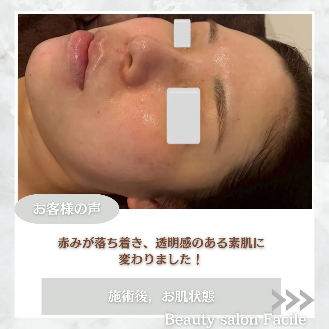 @beautysalonfacile 👈🏻他投稿もチェック