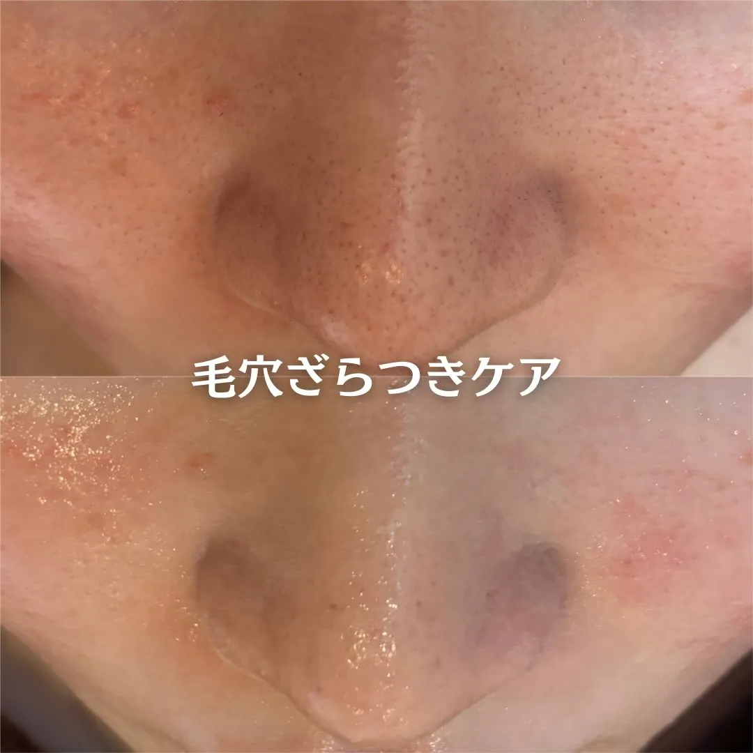 @beautysalonfacile 👈🏻他投稿もチェック