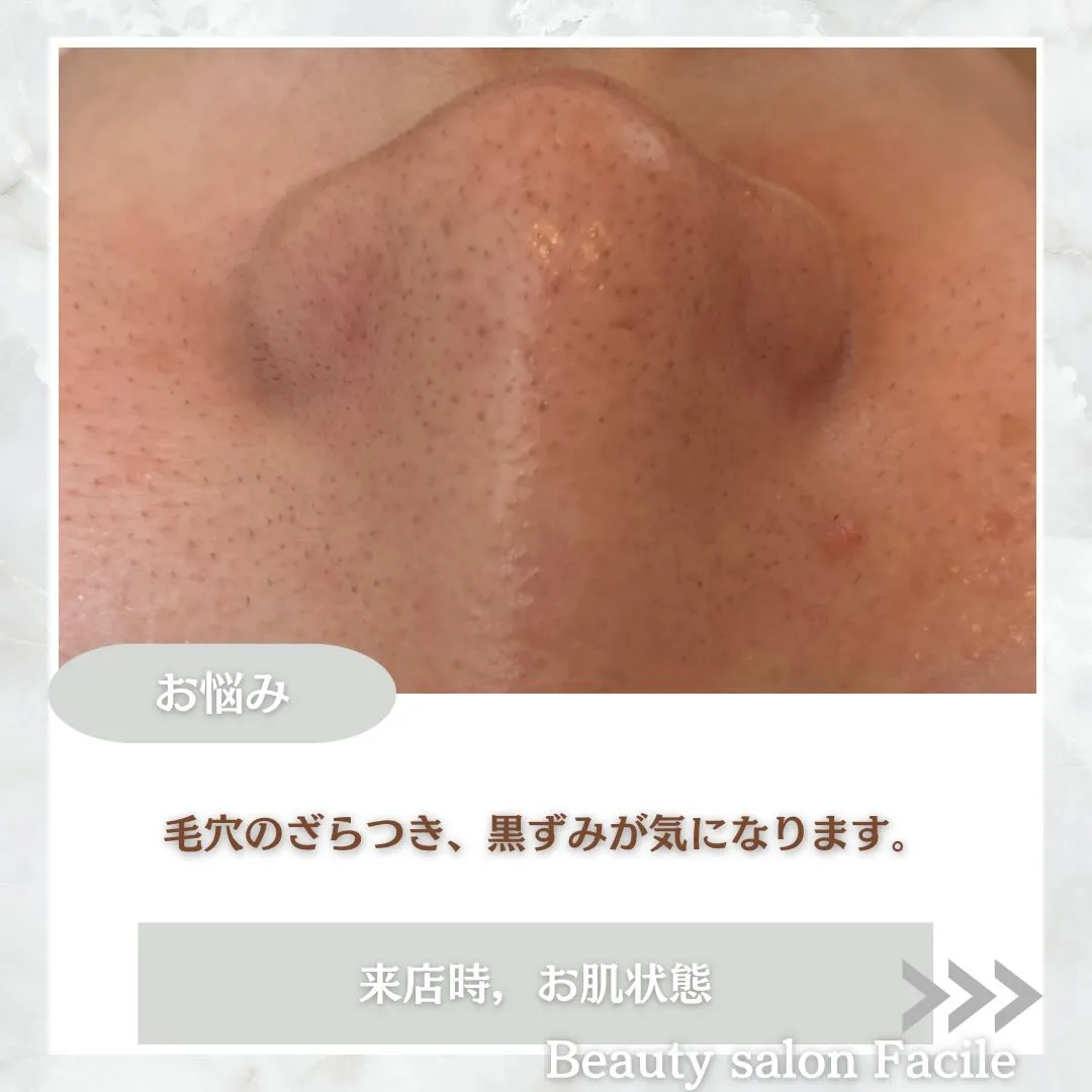 @beautysalonfacile 👈🏻他投稿もチェック