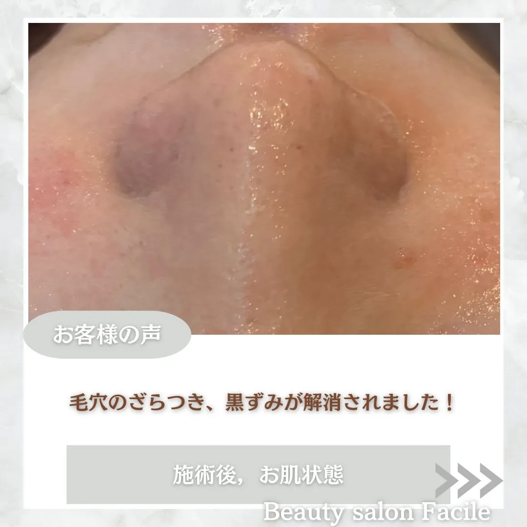 @beautysalonfacile 👈🏻他投稿もチェック