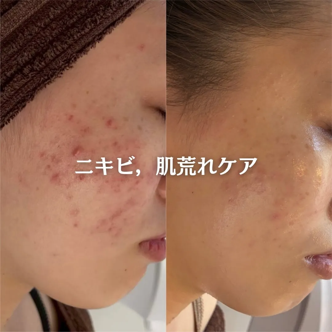 @beautysalonfacile 👈🏻他投稿もチェック