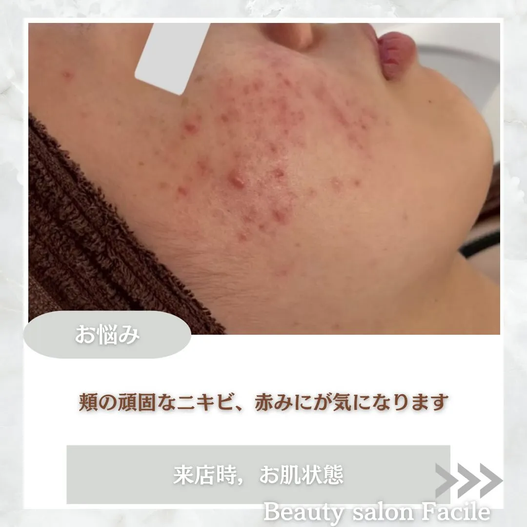 @beautysalonfacile 👈🏻他投稿もチェック