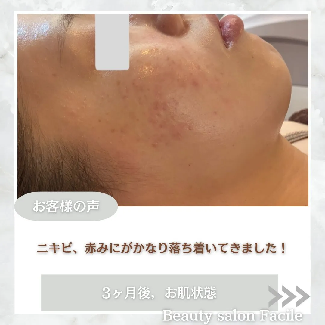@beautysalonfacile 👈🏻他投稿もチェック