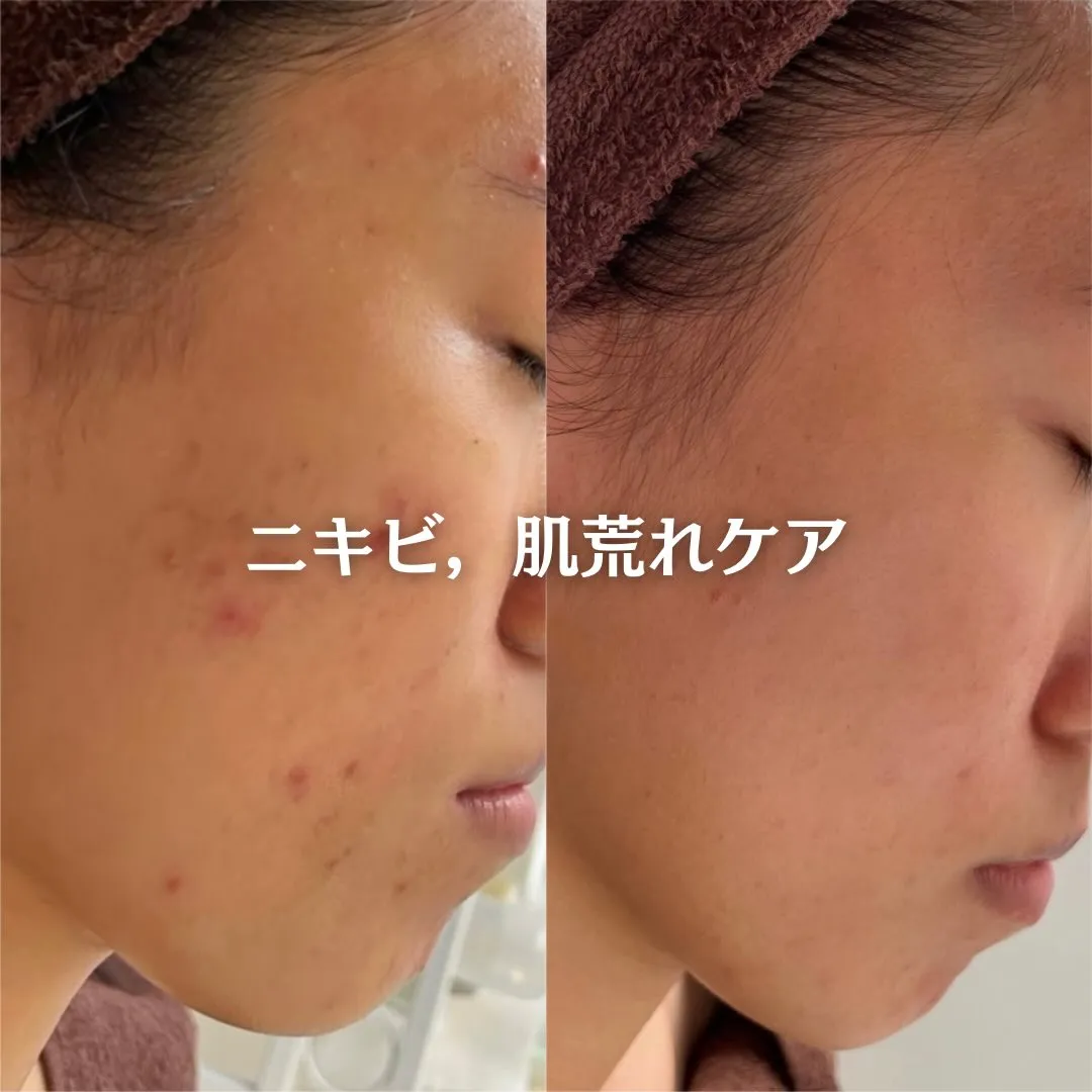 @beautysalonfacile 👈🏻他投稿もチェック