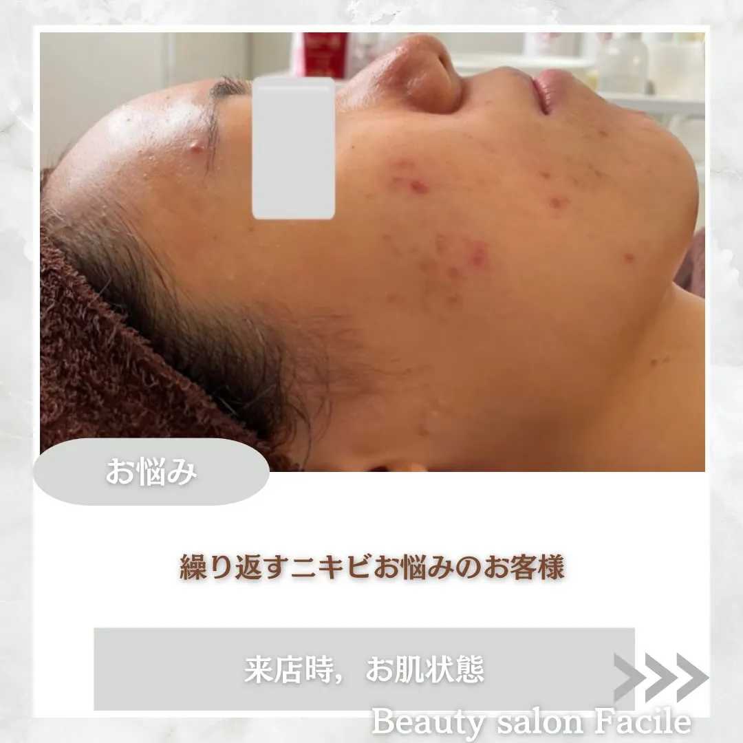 @beautysalonfacile 👈🏻他投稿もチェック