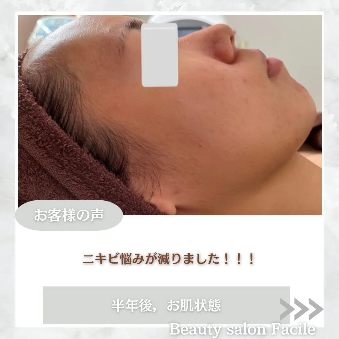 @beautysalonfacile 👈🏻他投稿もチェック