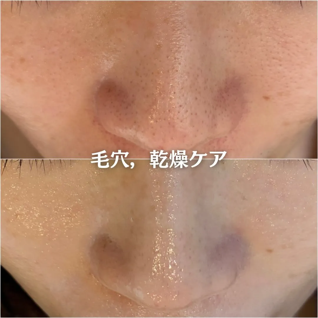 @beautysalonfacile 👈🏻他投稿もチェック
