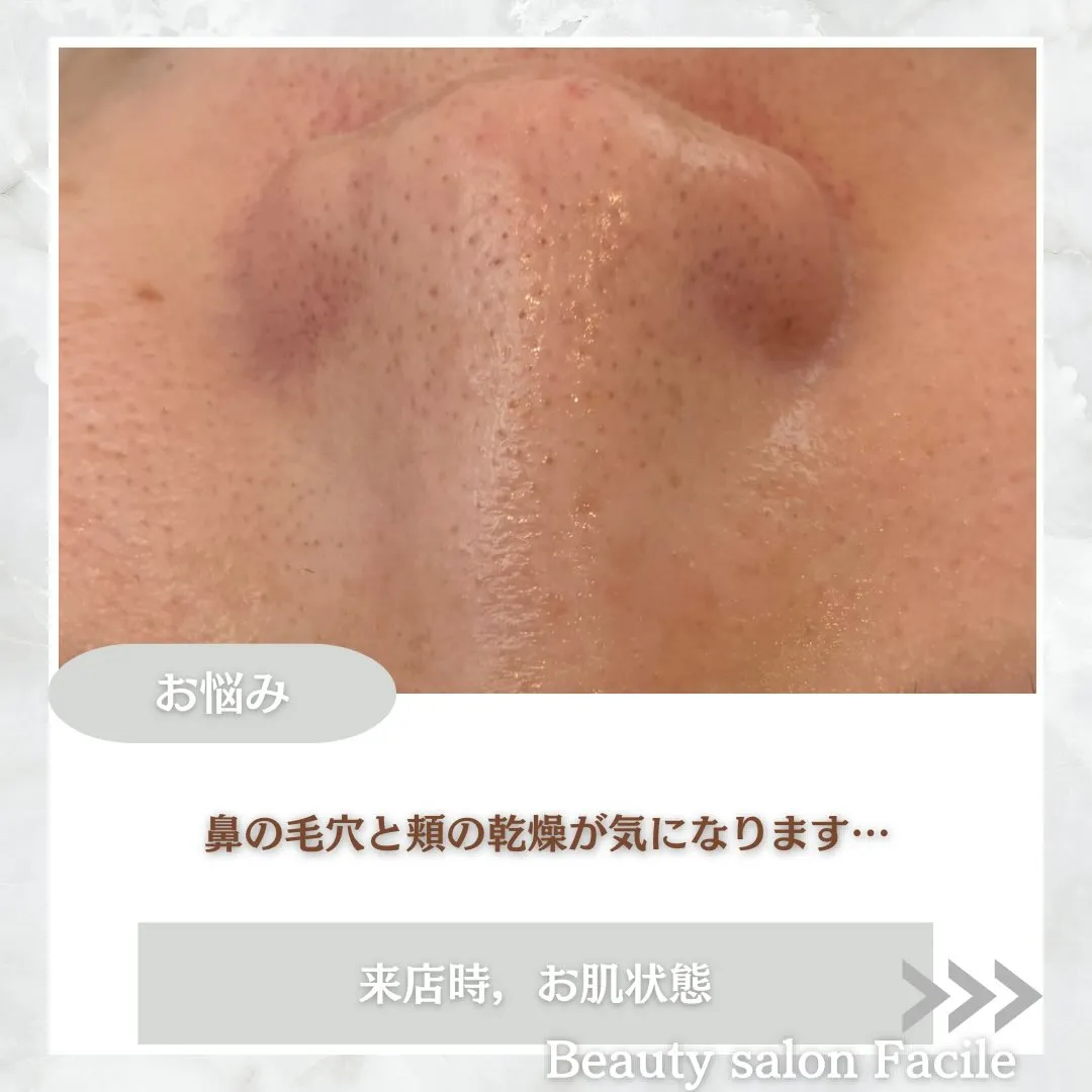 @beautysalonfacile 👈🏻他投稿もチェック