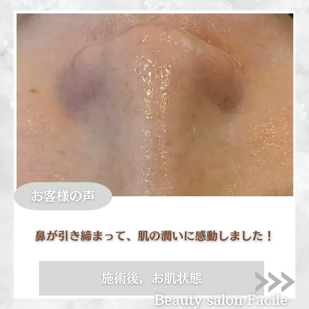 @beautysalonfacile 👈🏻他投稿もチェック