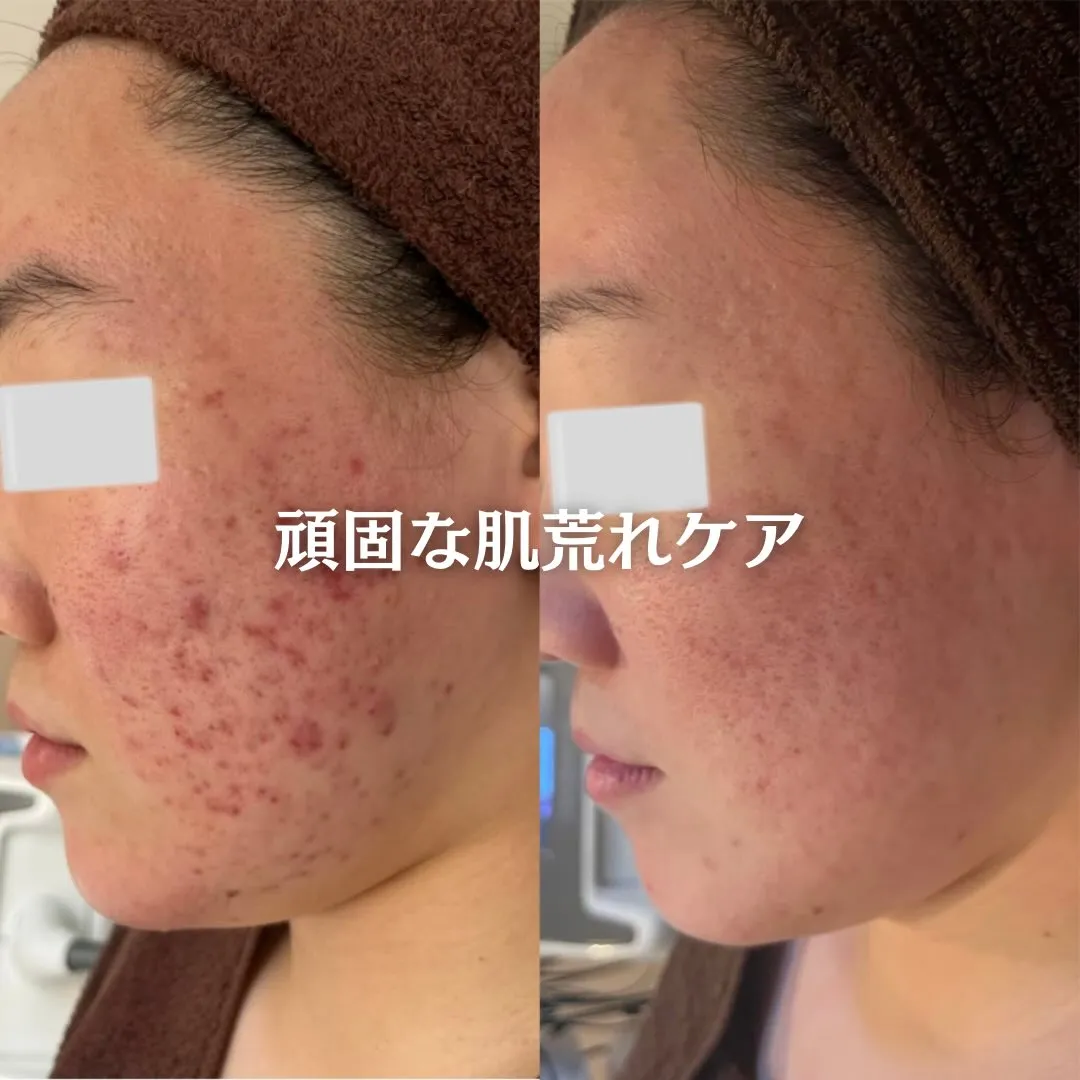 @beautysalonfacile 👈🏻他投稿もチェック