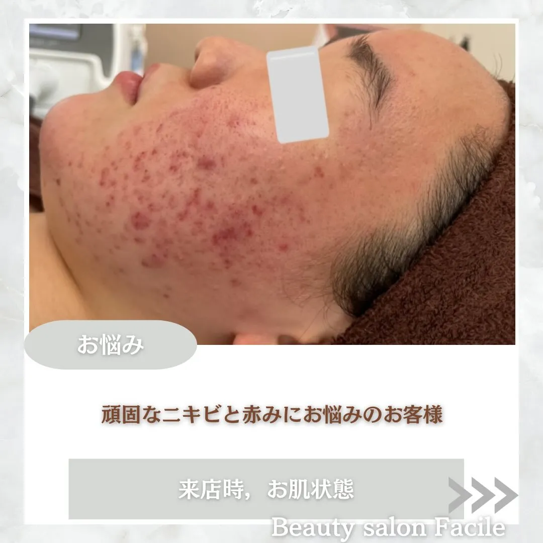 @beautysalonfacile 👈🏻他投稿もチェック