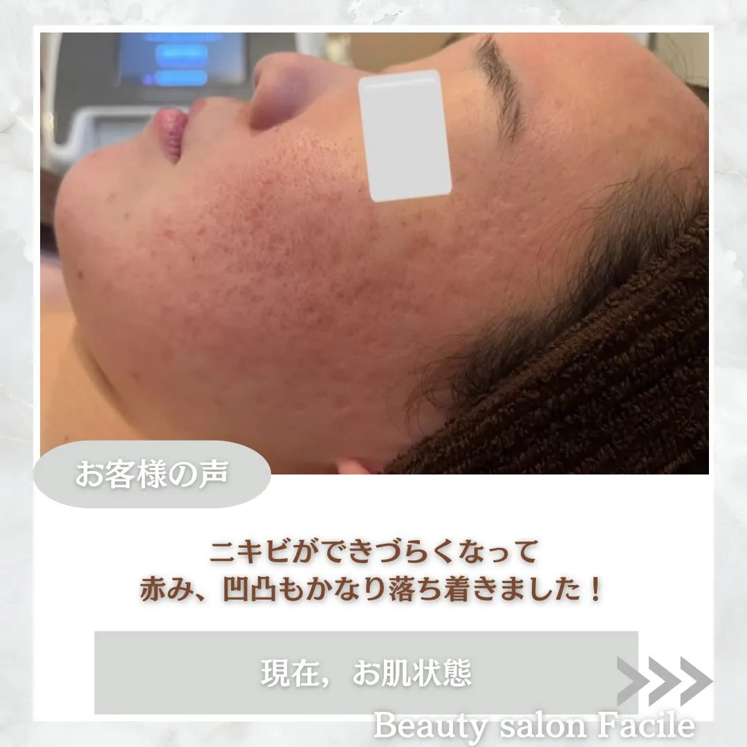 @beautysalonfacile 👈🏻他投稿もチェック