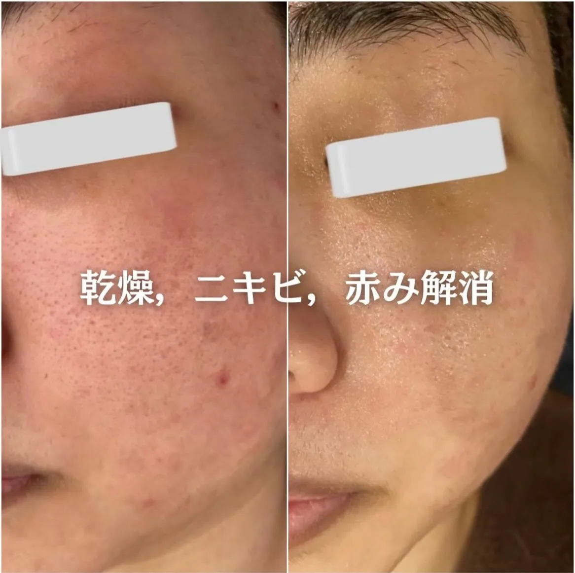 @beautysalonfacile 👈🏻他投稿もチェック