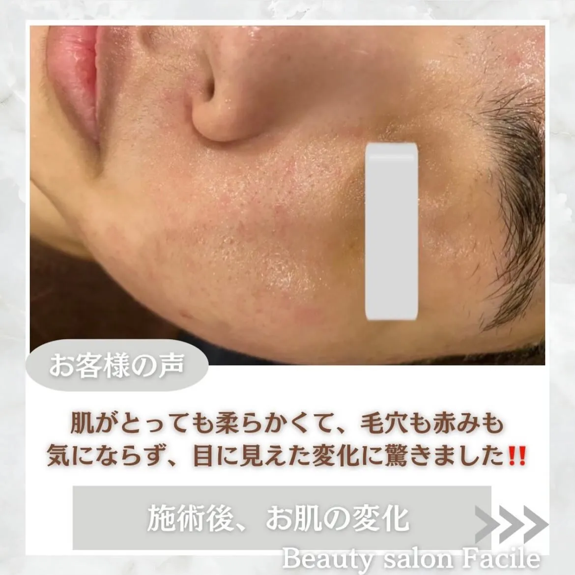 @beautysalonfacile 👈🏻他投稿もチェック
