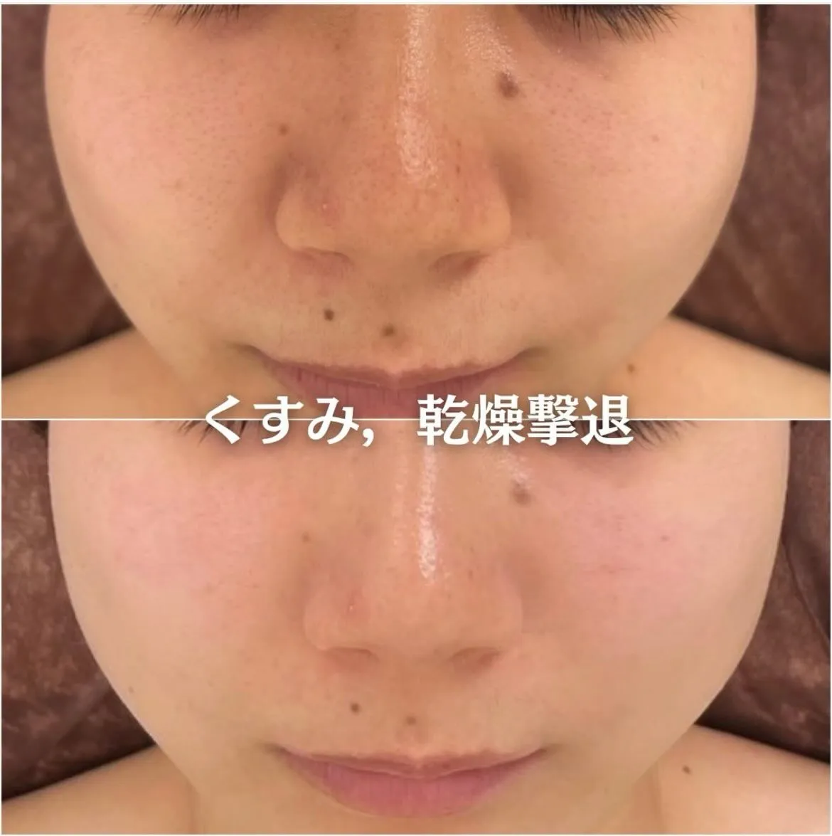 @beautysalonfacile 👈🏻他投稿もチェック