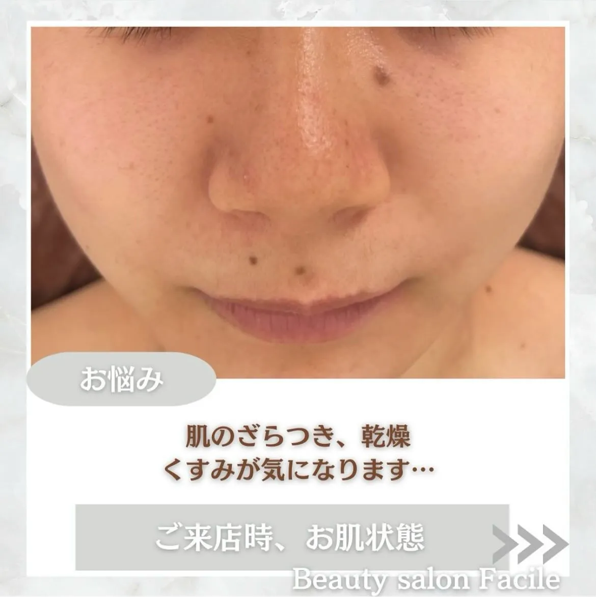 @beautysalonfacile 👈🏻他投稿もチェック