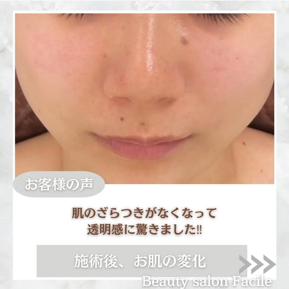@beautysalonfacile 👈🏻他投稿もチェック