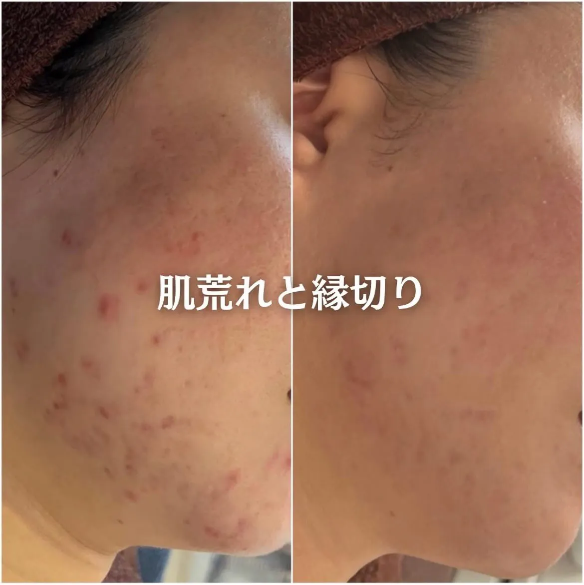 @beautysalonfacile 👈🏻他投稿もチェック