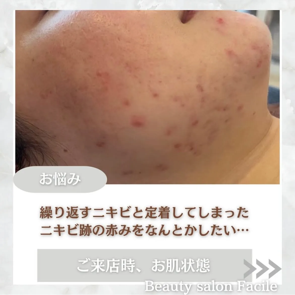 @beautysalonfacile 👈🏻他投稿もチェック