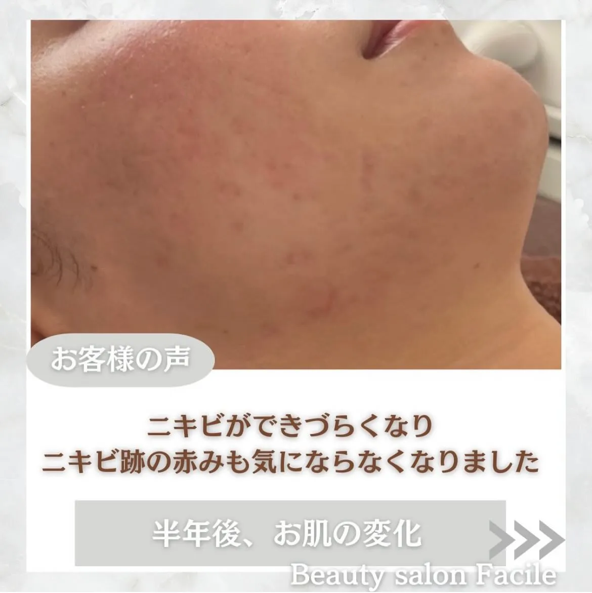 @beautysalonfacile 👈🏻他投稿もチェック