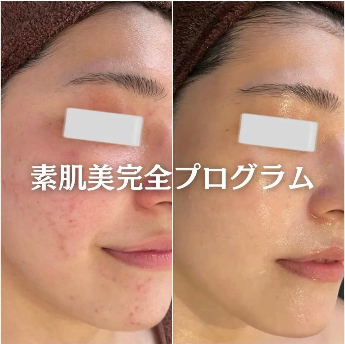@beautysalonfacile 👈🏻他投稿もチェック