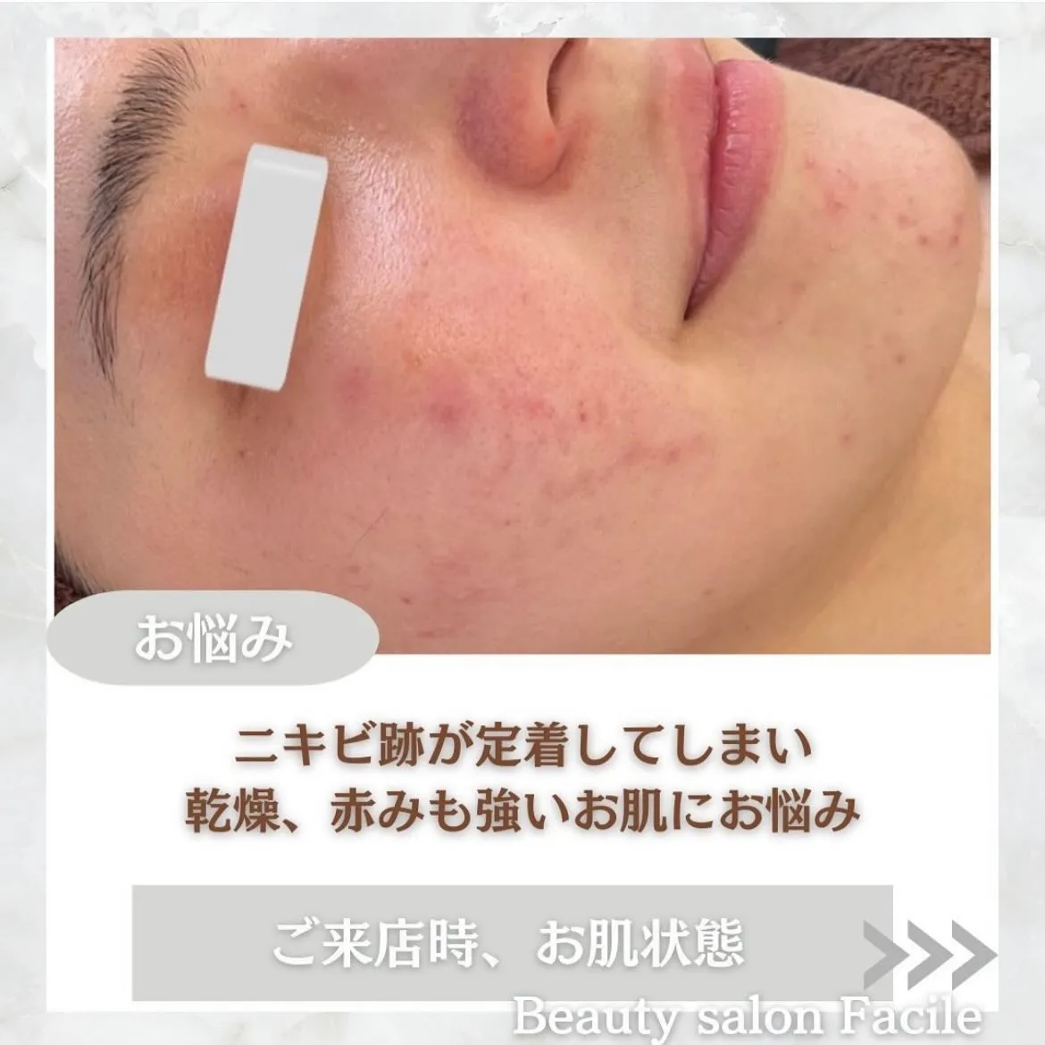 @beautysalonfacile 👈🏻他投稿もチェック