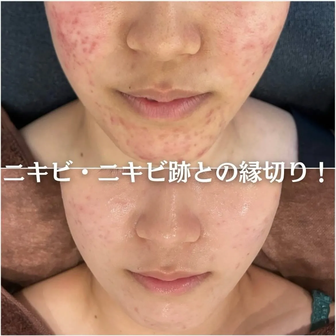 @beautysalonfacile 👈🏻他投稿もチェック