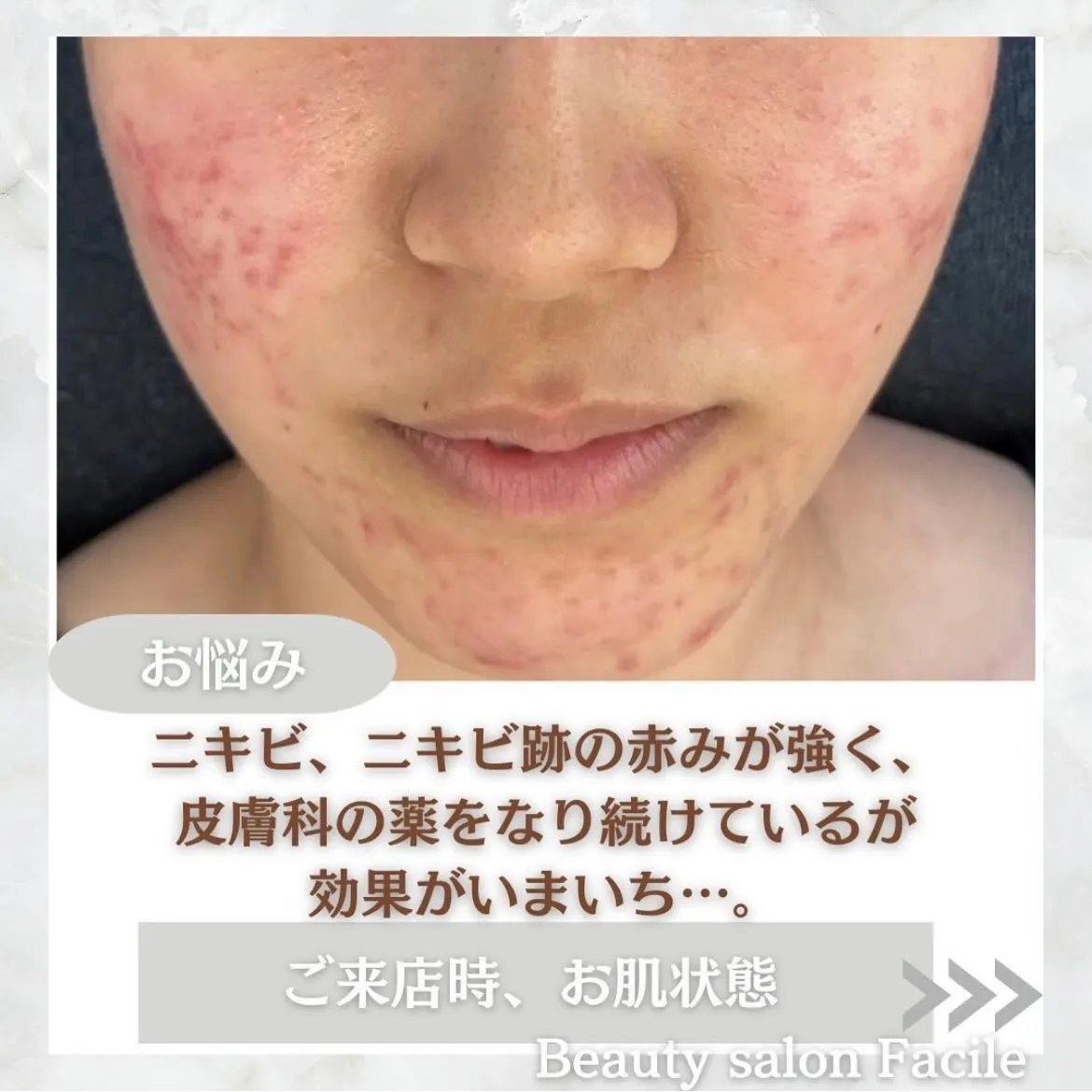 @beautysalonfacile 👈🏻他投稿もチェック