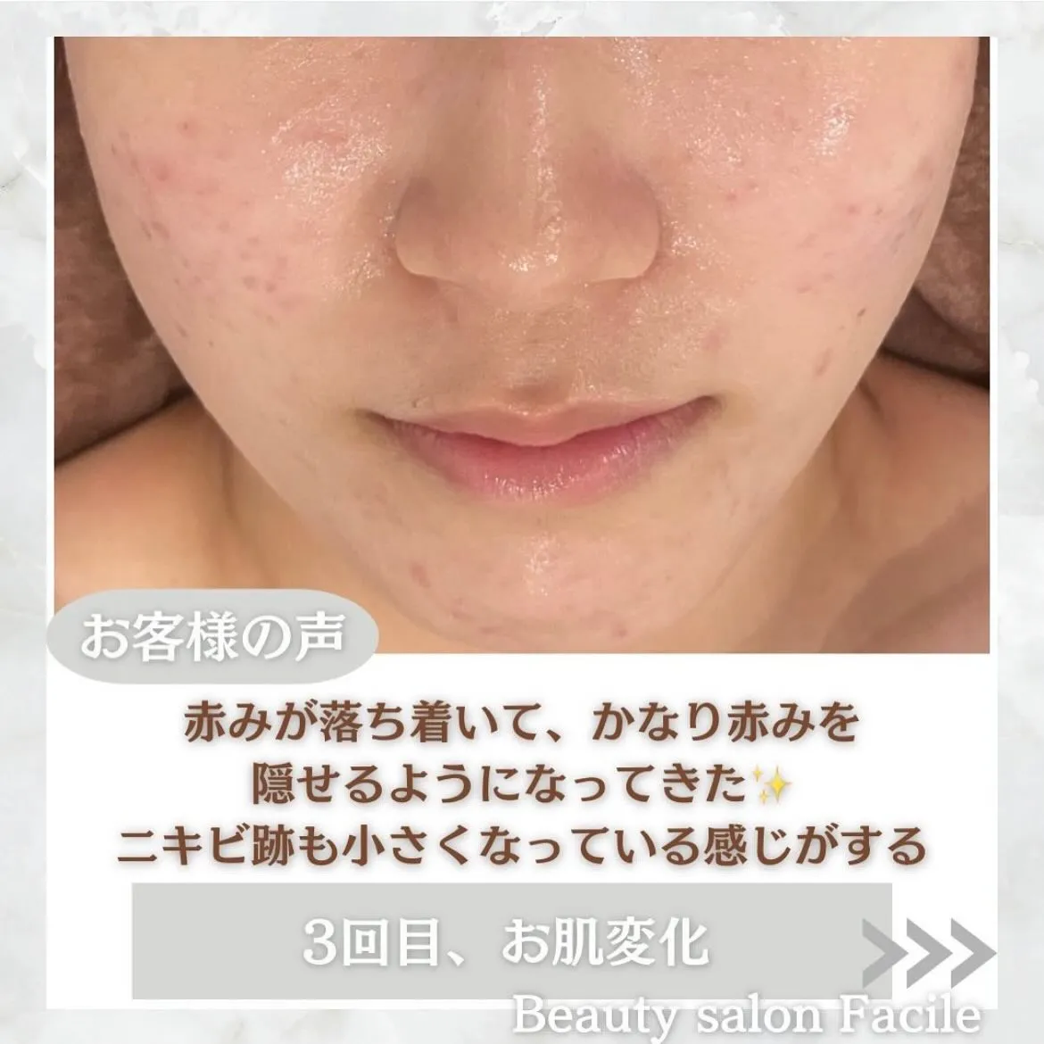 @beautysalonfacile 👈🏻他投稿もチェック