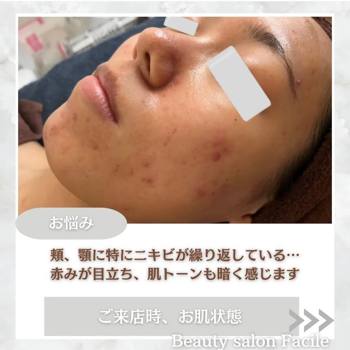@beautysalonfacile 👈🏻他投稿もチェック