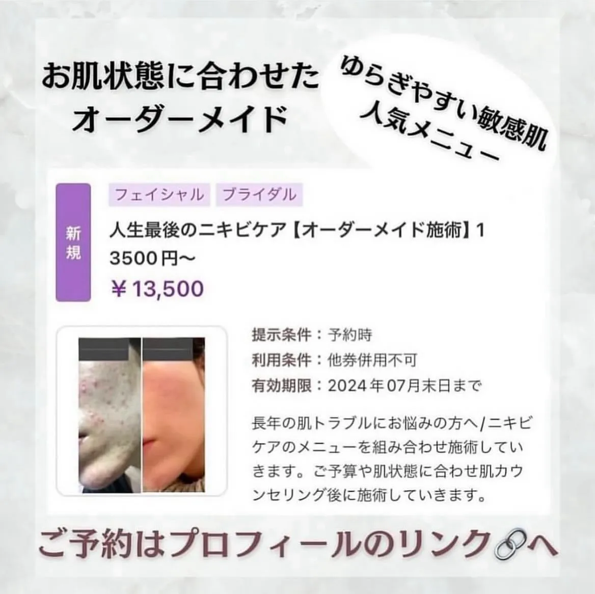 @beautysalonfacile 👈🏻他投稿もチェック