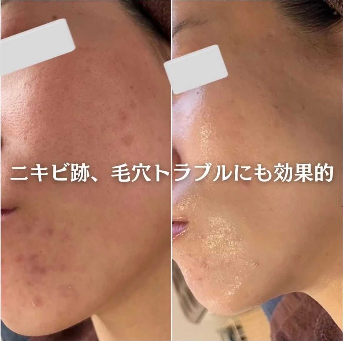 @beautysalonfacile 👈🏻他投稿もチェック