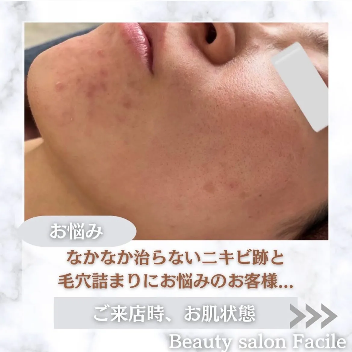 @beautysalonfacile 👈🏻他投稿もチェック