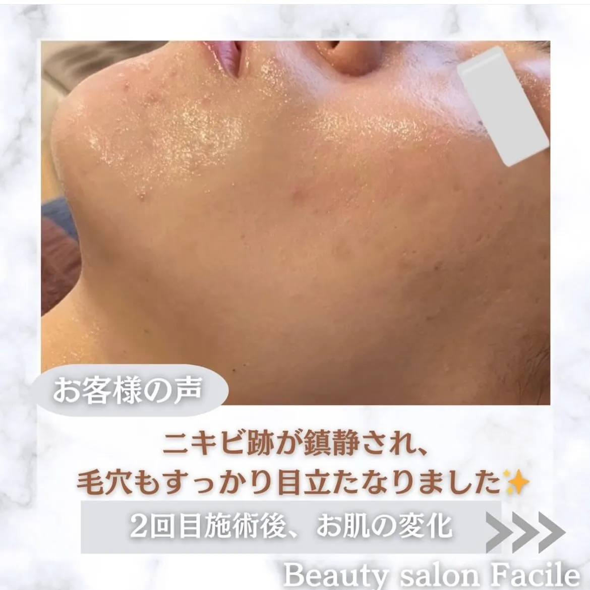 @beautysalonfacile 👈🏻他投稿もチェック