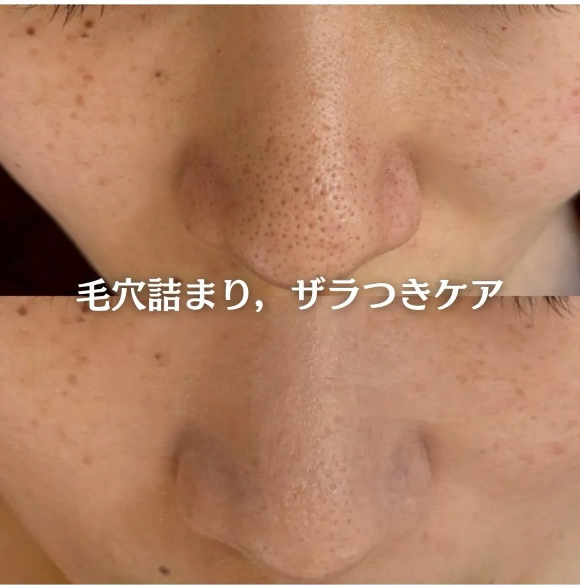 @beautysalonfacile 👈🏻他投稿もチェック
