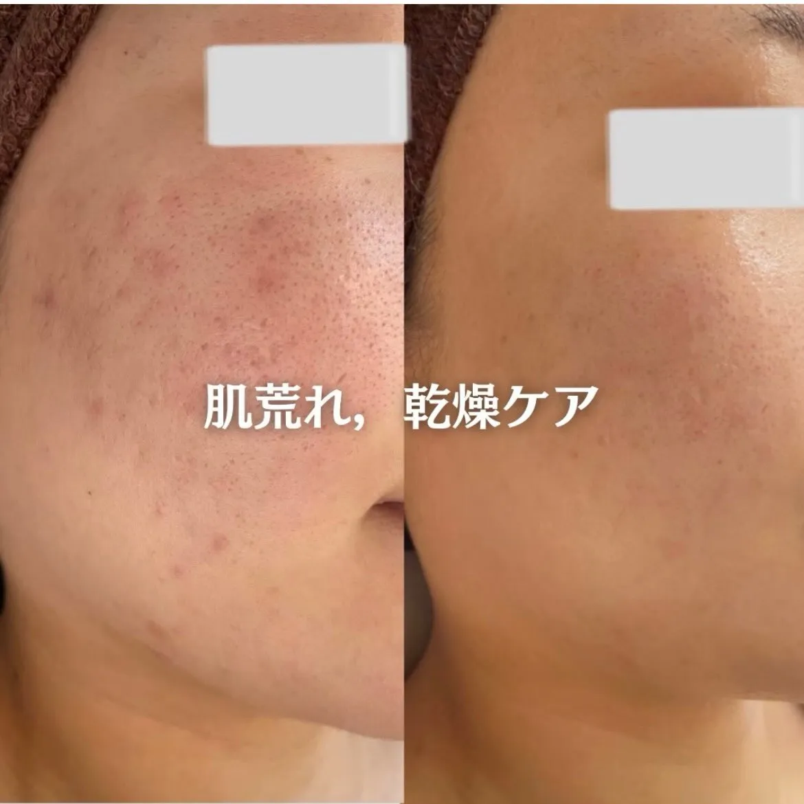 @beautysalonfacile 👈🏻他投稿もチェック